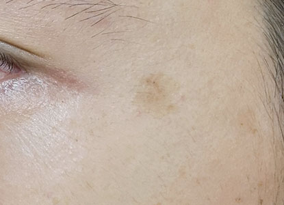 ホワイトルマン使用0日目