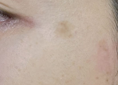 ホワイトルマン使用15日目