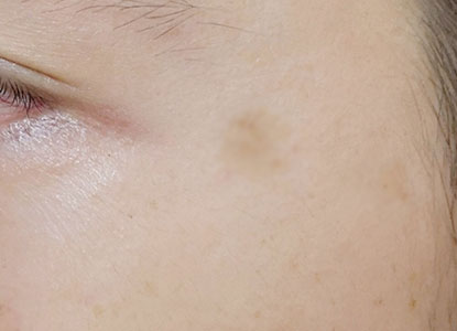 ホワイトルマン使用30日目